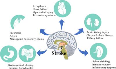 Peripheral Organ Injury After Stroke